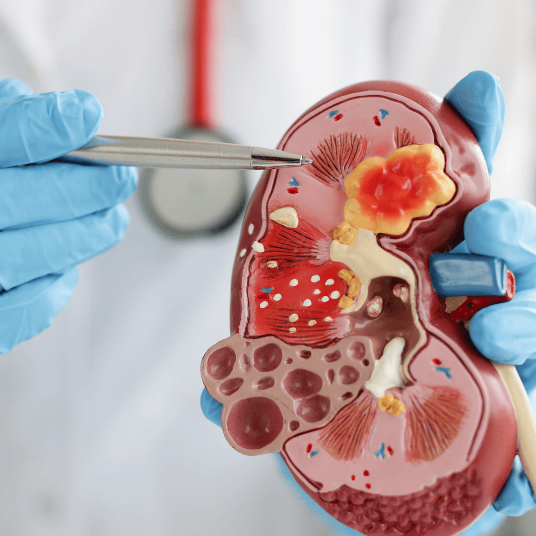 Nephrology