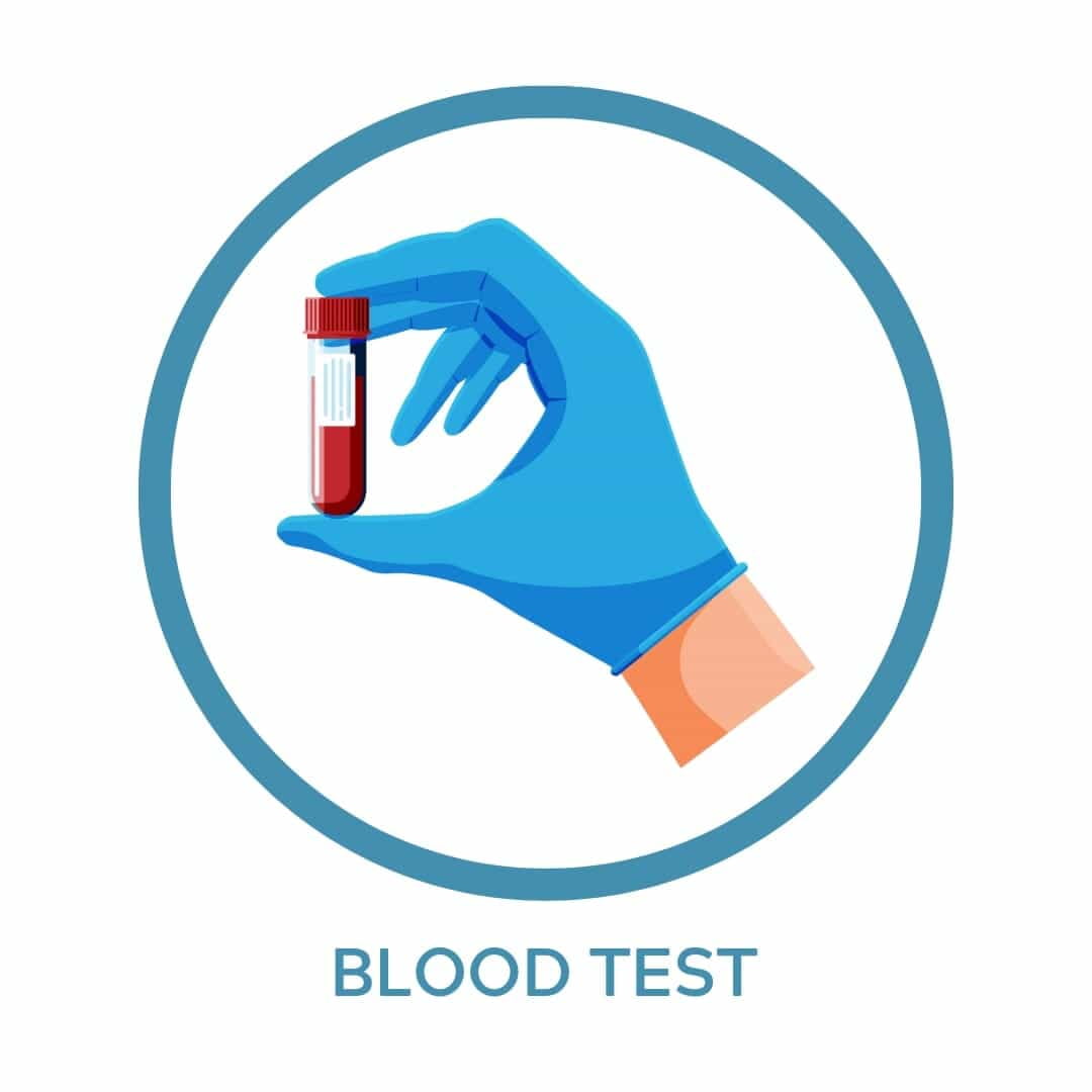 BSR ( Blood sugar random)