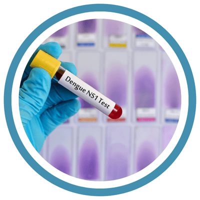 DENGUE NS1 ANTIGEN DENGUE NS1 ANTIGEN