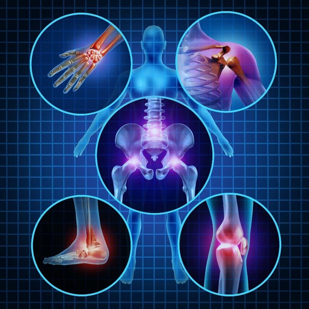 Orthopedic
